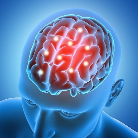 Cerebrovascular Disease Treatment in Navi Mumbai