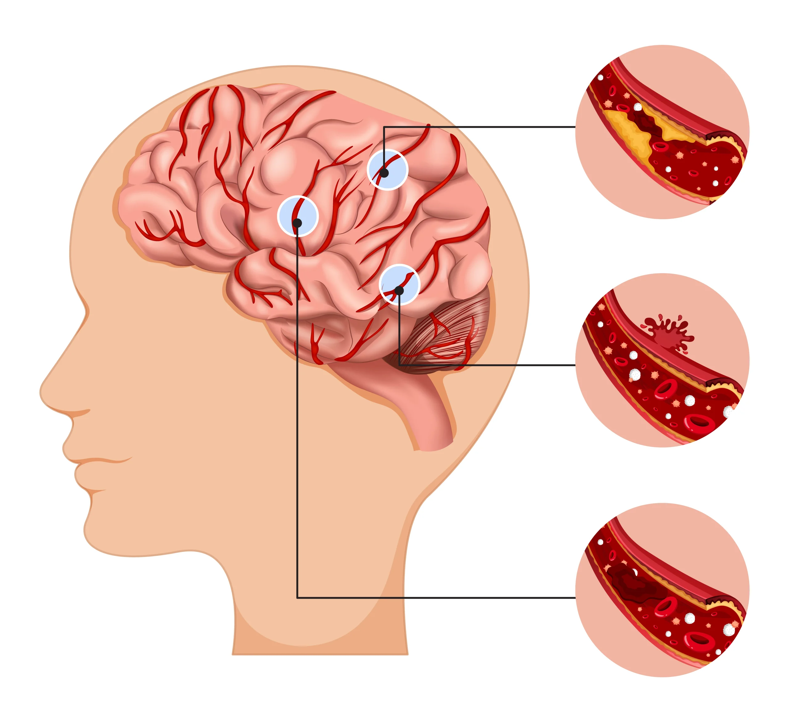 How to Choose the Best Neurosurgeon in Navi Mumbai
